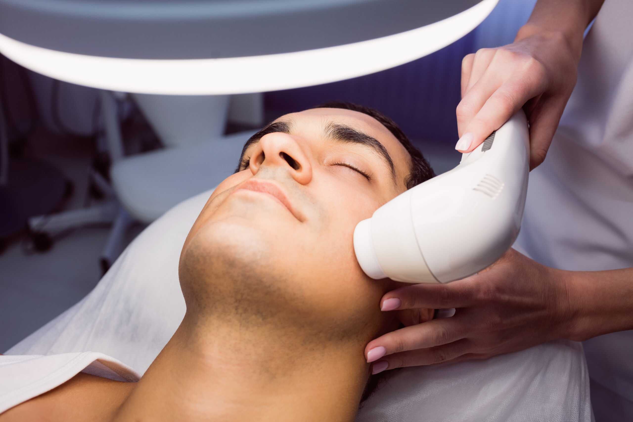 Microneedling treatment for a male patient